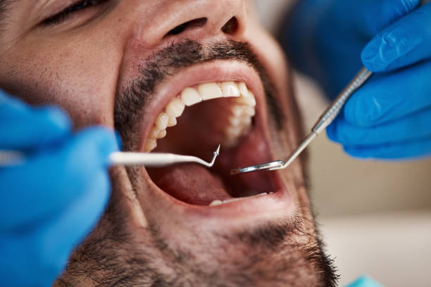 Best Laser Dentistry  in Ntgomery City, MO